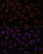 VILL Antibody in Immunocytochemistry (ICC/IF)