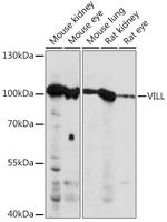 VILL Antibody in Western Blot (WB)