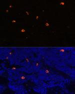 Cathelicidin Antibody in Immunocytochemistry (ICC/IF)