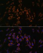 RPS13 Antibody in Immunocytochemistry (ICC/IF)