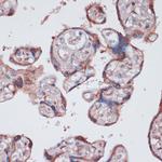 RPS13 Antibody in Immunohistochemistry (Paraffin) (IHC (P))