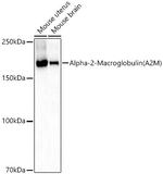 A2M Antibody in Western Blot (WB)