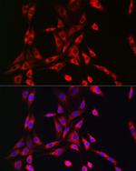 PIK3R4 Antibody in Immunocytochemistry (ICC/IF)