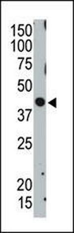 TSG101 Antibody in Western Blot (WB)