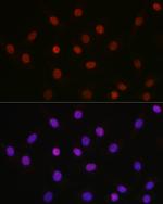 Acetyl-HMGB1 (Lys29) Antibody in Immunocytochemistry (ICC/IF)