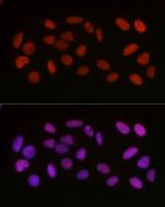 Acetyl-HMGB1 (Lys29) Antibody in Immunocytochemistry (ICC/IF)