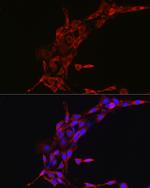 Cyclin B1 Antibody in Immunocytochemistry (ICC/IF)