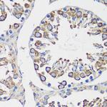 Cyclin B1 Antibody in Immunohistochemistry (Paraffin) (IHC (P))