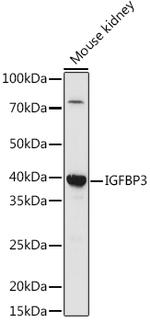 IGFBP3 Antibody in Western Blot (WB)