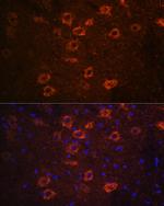 VAChT Antibody in Immunohistochemistry (Paraffin) (IHC (P))