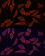 TRAPPC6A Antibody in Immunocytochemistry (ICC/IF)