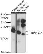 TRAPPC6A Antibody in Western Blot (WB)