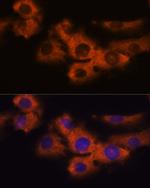 NDRG4 Antibody in Immunocytochemistry (ICC/IF)