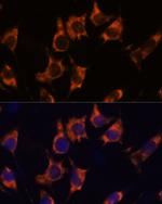 NDRG4 Antibody in Immunocytochemistry (ICC/IF)