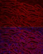 ACSL1 Antibody in Immunohistochemistry (Paraffin) (IHC (P))