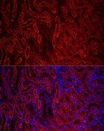 ACSL1 Antibody in Immunohistochemistry (Paraffin) (IHC (P))