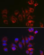 BOK Antibody in Immunocytochemistry (ICC/IF)