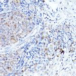 BOK Antibody in Immunohistochemistry (Paraffin) (IHC (P))