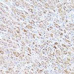 BOK Antibody in Immunohistochemistry (Paraffin) (IHC (P))