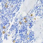 NOX2 Antibody in Immunohistochemistry (Paraffin) (IHC (P))