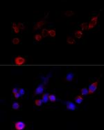 Filamin A Antibody in Immunocytochemistry (ICC/IF)