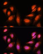 SPT6 Antibody in Immunocytochemistry (ICC/IF)