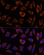 CTNNA3 Antibody in Immunocytochemistry (ICC/IF)