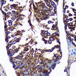 CTNNA3 Antibody in Immunohistochemistry (Paraffin) (IHC (P))