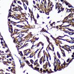 CTNNA3 Antibody in Immunohistochemistry (Paraffin) (IHC (P))