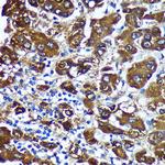 CTNNA3 Antibody in Immunohistochemistry (Paraffin) (IHC (P))