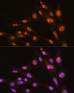 YY2 Antibody in Immunocytochemistry (ICC/IF)