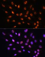 YY2 Antibody in Immunocytochemistry (ICC/IF)