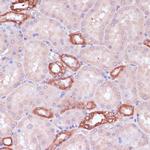 UGT2B15 Antibody in Immunohistochemistry (Paraffin) (IHC (P))