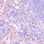 UGT2B15 Antibody in Immunohistochemistry (Paraffin) (IHC (P))