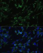 CHRM1 Antibody in Immunocytochemistry (ICC/IF)