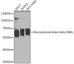 GBA Antibody in Western Blot (WB)