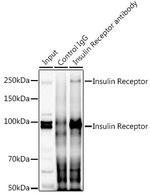 INSR Antibody in Immunoprecipitation (IP)