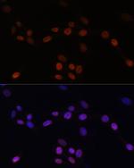 Lamin B1 Antibody in Immunocytochemistry (ICC/IF)