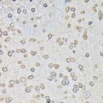 Lamin B1 Antibody in Immunohistochemistry (Paraffin) (IHC (P))