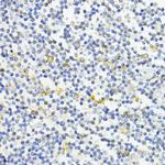 AMPK alpha-1 Antibody in Immunohistochemistry (Paraffin) (IHC (P))