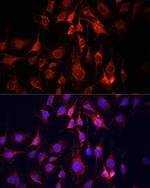 UCP3 Antibody in Immunocytochemistry (ICC/IF)