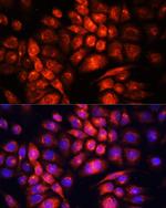 UCP3 Antibody in Immunocytochemistry (ICC/IF)