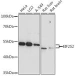 eIF2 beta Antibody in Western Blot (WB)