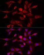 DNM1L Antibody in Immunocytochemistry (ICC/IF)