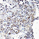 YAP1 Antibody in Immunohistochemistry (Paraffin) (IHC (P))