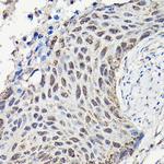 YAP1 Antibody in Immunohistochemistry (Paraffin) (IHC (P))