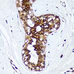 HSD17B7 Antibody in Immunohistochemistry (Paraffin) (IHC (P))