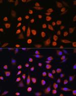 EDEM2 Antibody in Immunocytochemistry (ICC/IF)