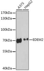 EDEM2 Antibody in Western Blot (WB)