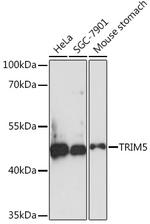 TRIM5 beta Antibody in Western Blot (WB)